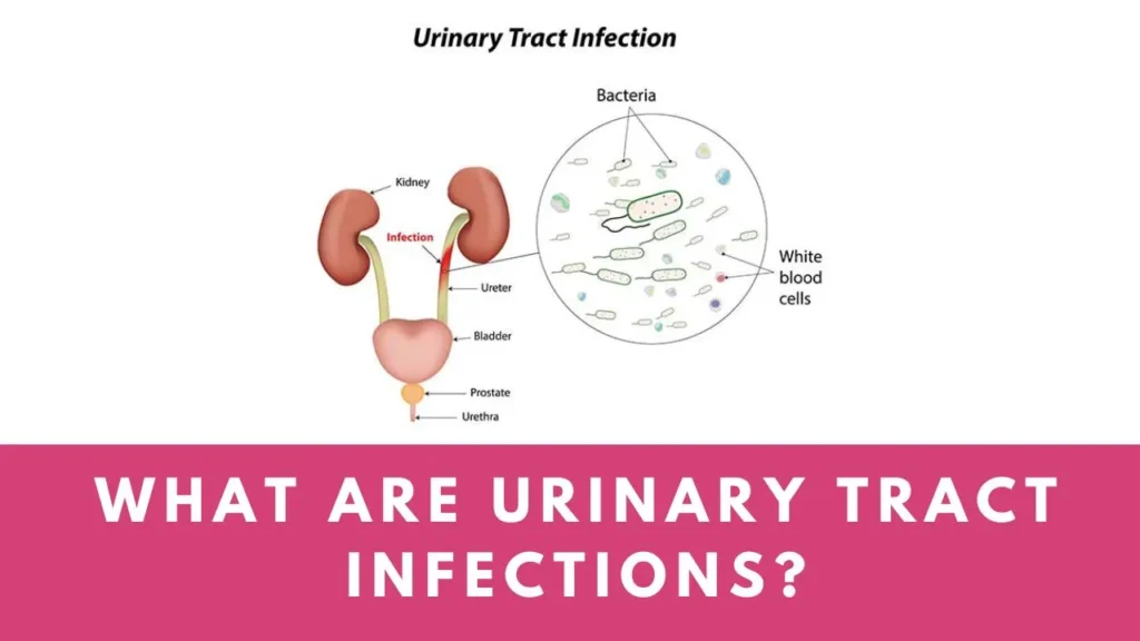 What are urinary tract infections? How to prevent and treat - Sayzn